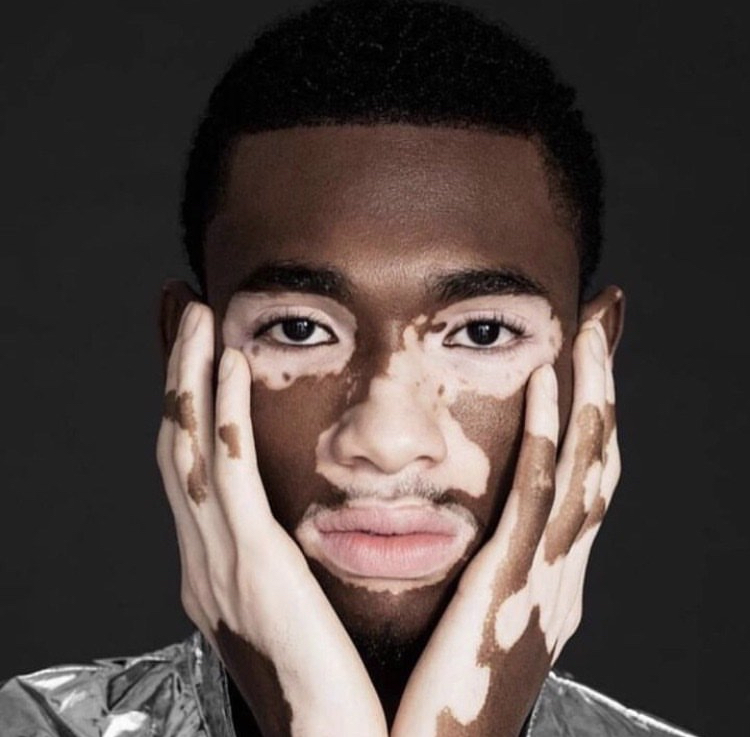 The Diversity in Fashion Model Development Program By Sizzle Arts : Breaking Barriers in Fashion