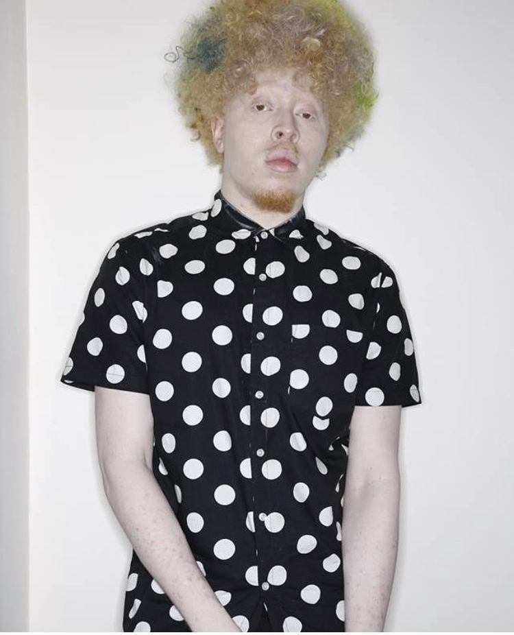 Albino Model Showcases @ Sizzle Arts Diversity Model Program