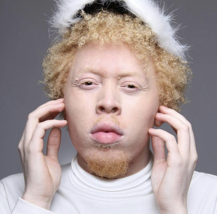 ALBINO MODEL SHOWCASES @ SIZZLE ARTS DIVERSITY MODEL PROGRAM